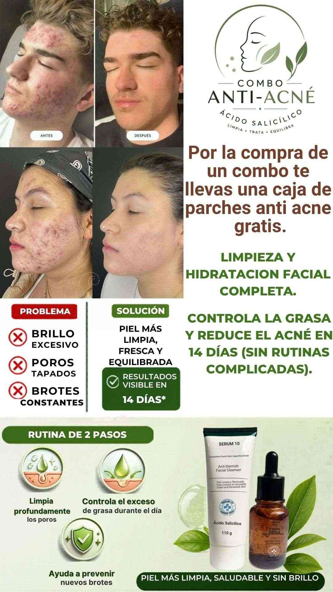 Deja de luchar contra el acné: Mejora tu piel en solo 14 días
